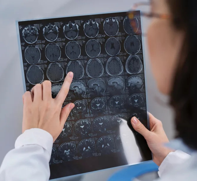 Neurology